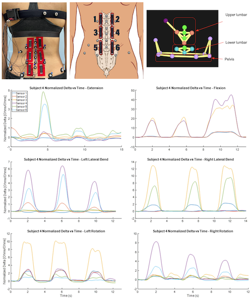MS-ADAPT research flow diagram showing data collection from fabric sensors and wrist accelerometers, integration with patient-reported outcomes, and machine learning analytics for personalized physical therapy